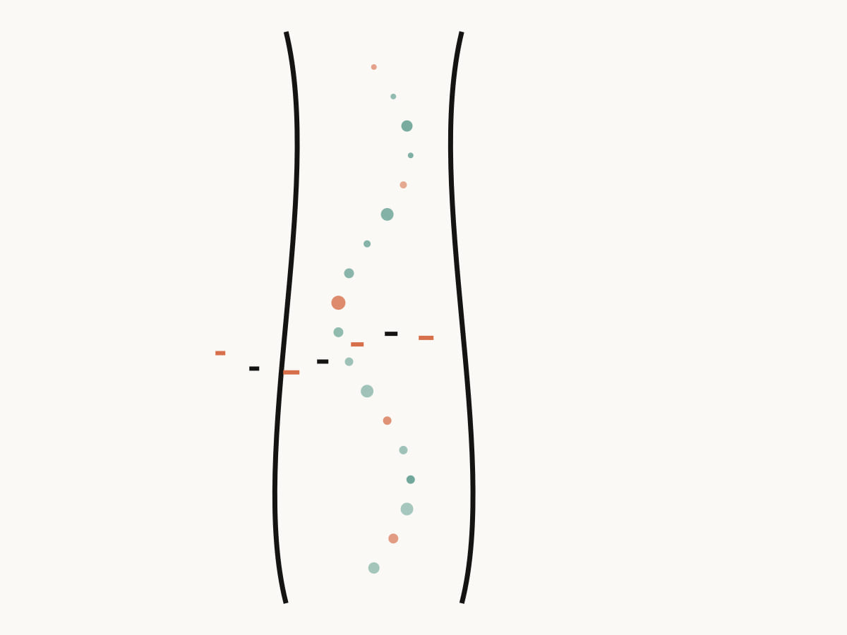 Two bending black seams hold a vertical stream of colored marks around one narrow opening, representing ADHD paralysis at school.